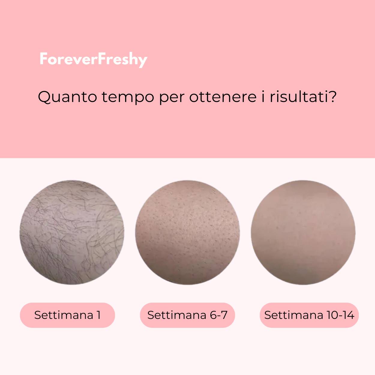 Freshy® depilatore a luce pulsata